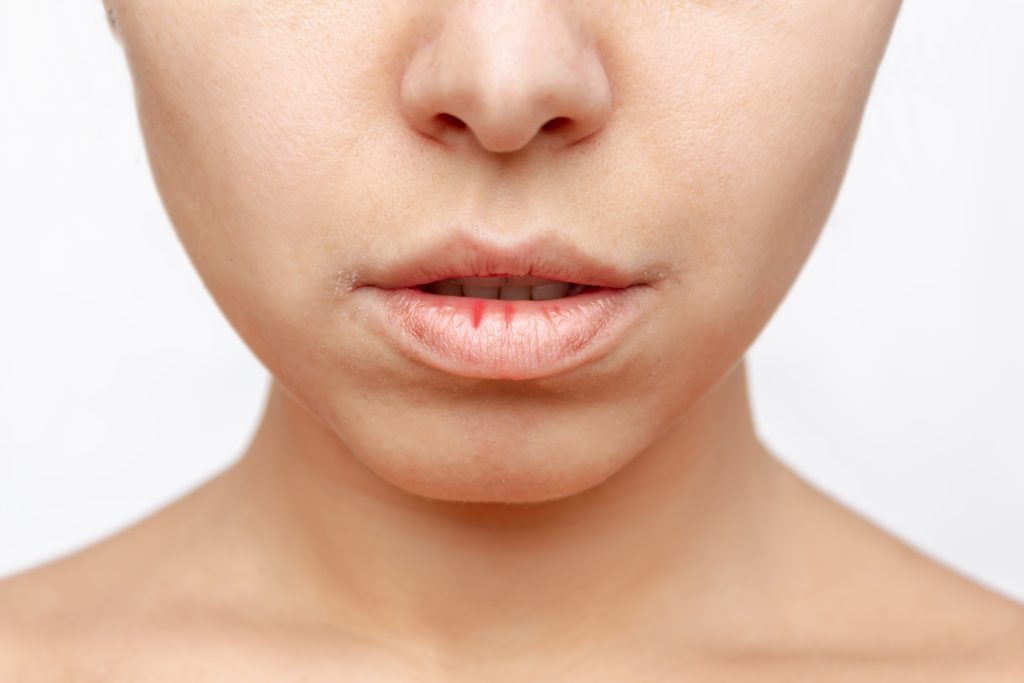 dry mouth and lips
